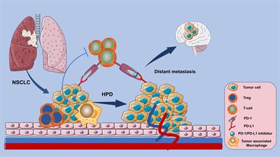 Hyperprogressive disease in non-small cell lung cancer after PD-1/PD-L1 inhibitors immunotherapy: underlying killer